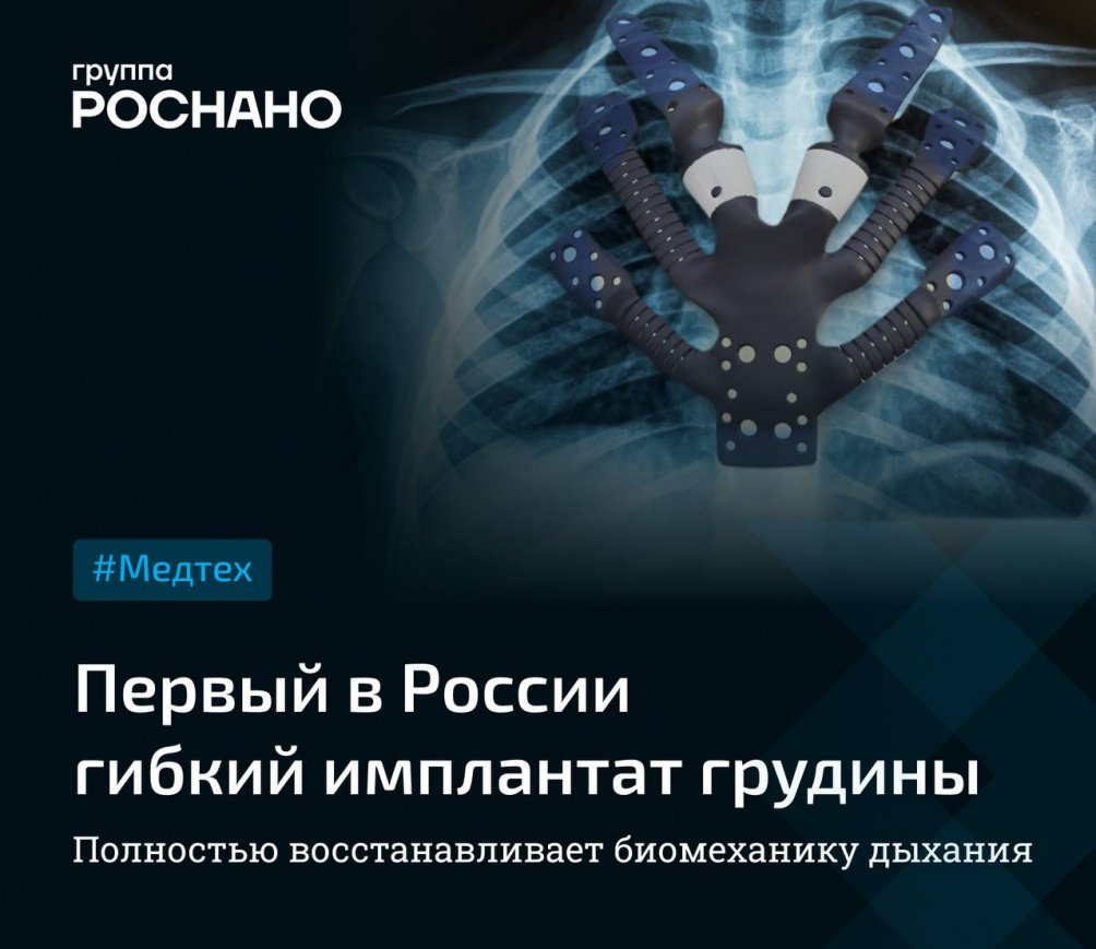Новые возможности медицины: Ученые из Группы «РОСНАНО» создали первый в России гибкий имплантат грудины